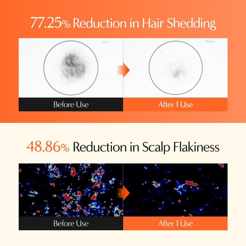 lilyeve GrowTurn 3D Volume Shampoo with Built-in Brush